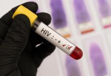 Aidshilfe kritisiert Kürzungen: Steigende HIV-Zahlen als politische Folge