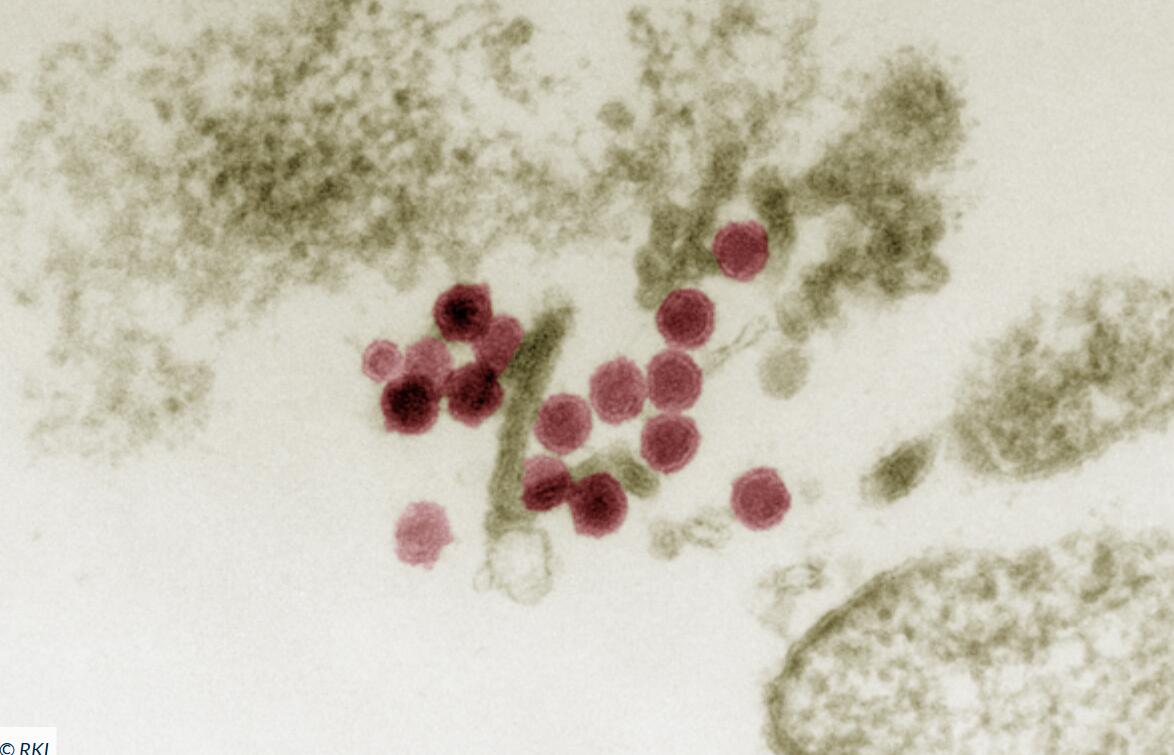 Ausbreitung des West-Nil-Virus in Deutschland